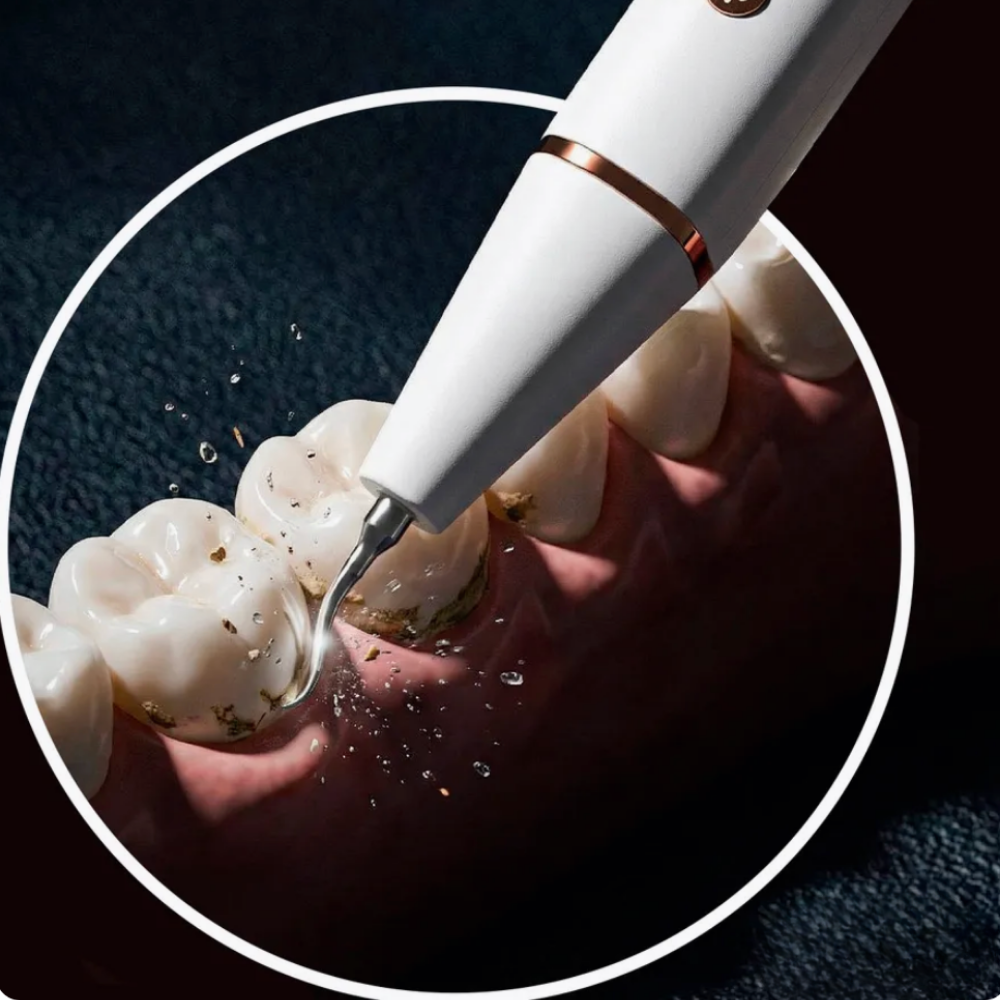 GlowSmile™ – Ultrasonic cleaning